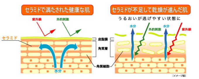 セラミドで満たされた健康な肌と、セラミドが不足して乾燥が進んだ肌のイメージ図